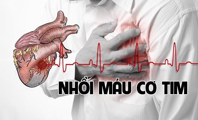Cách chăm sóc bệnh nhân nhồi máu cơ tim như thế nào