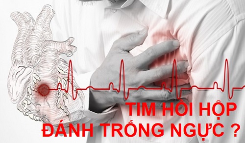 Cách chữa bệnh hồi hộp tim đập nhanh an toàn hiệu quả