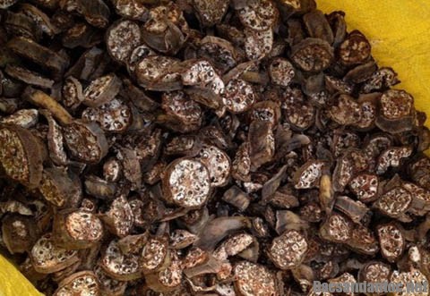 Cách chữa bệnh sỏi thận tại nhà an toàn hiệu quả