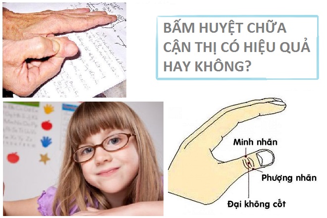 Cách chữa cận thị bằng cách bấm huyệt an toàn hiệu quả