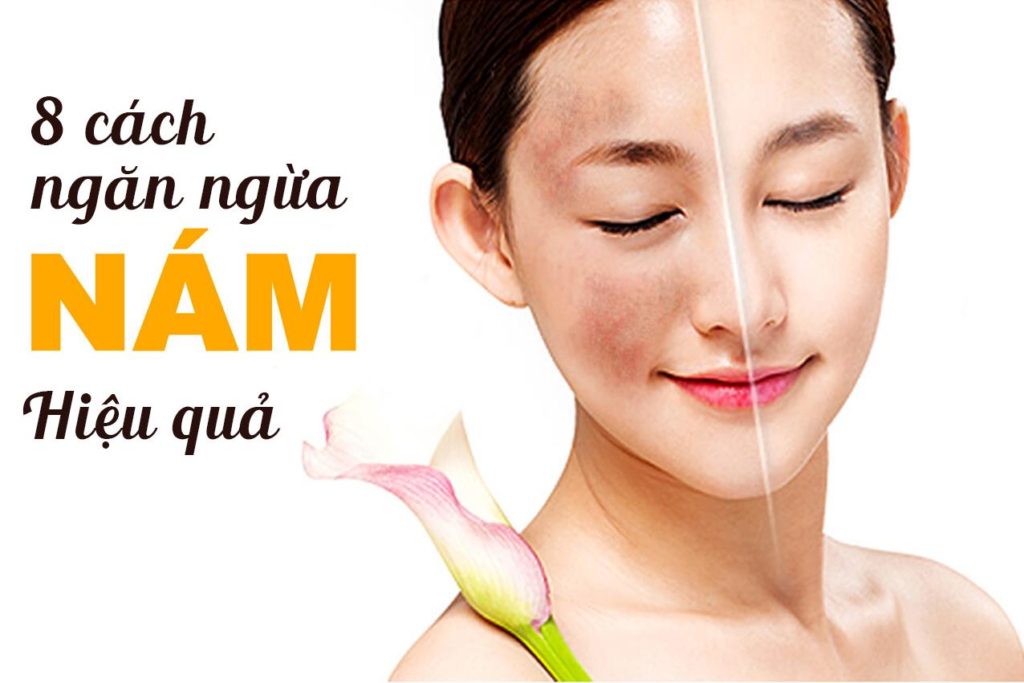 Cách chữa nám da nhanh nhất