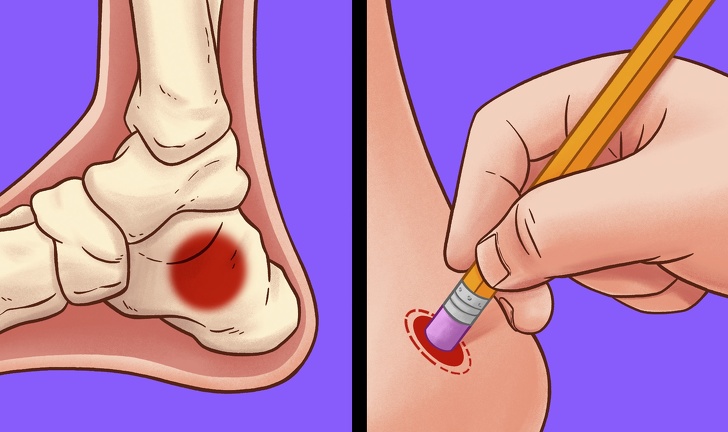 Cách chữa nhức mỏi chân hiệu quả