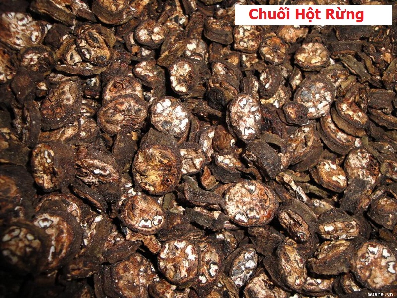 Cách chữa sỏi thận bằng chuối hột an toàn hiệu quả