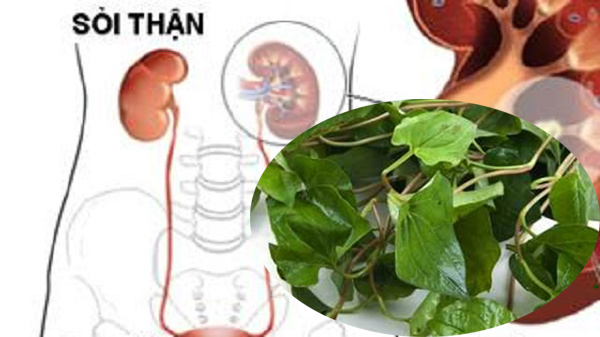 Cách chữa sỏi thận bằng rau diếp cá an toàn hiệu quả
