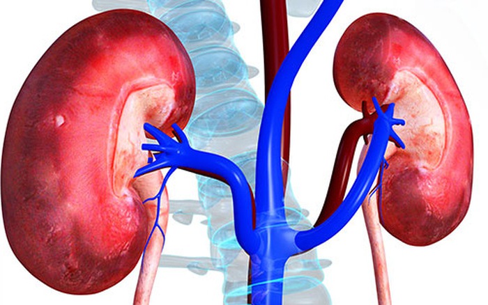 Cách chữa sỏi thận hiệu quả nhất và an toàn nhất