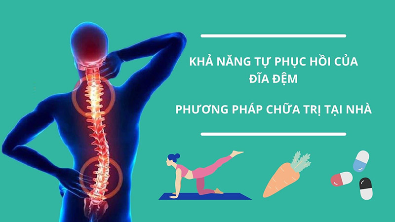 Cách chữa thoát vị đĩa đệm tại nhà như thế nào