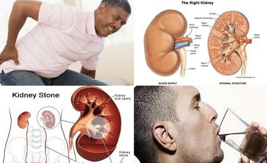 Cách chữa viêm đường tiết niệu ở nam giới như thế nào