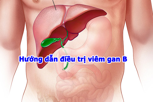 Cách điều trị viêm gan b hiệu quả nhất hiện nay