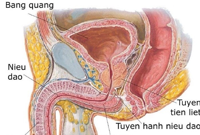 Cách điều trị viêm tuyến tiền liệt ở nam giới như thế nào