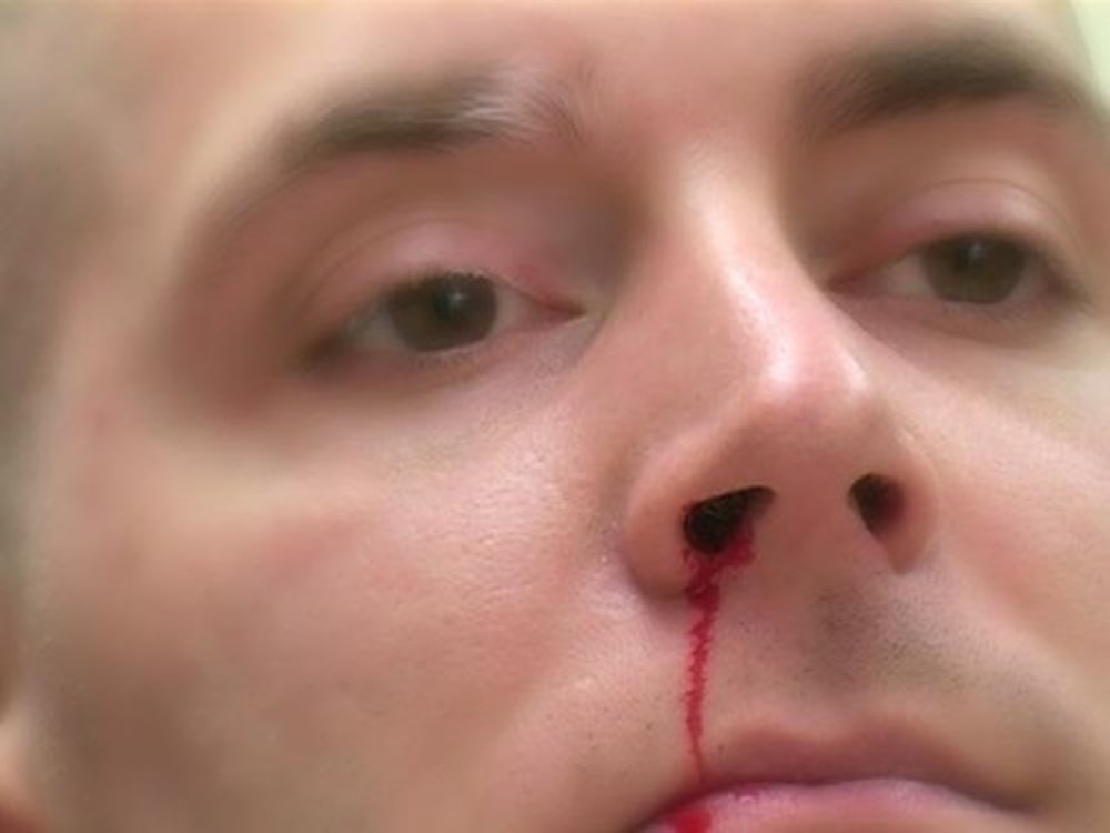 Cách hạ huyết áp nhanh tại nhà như thế nào