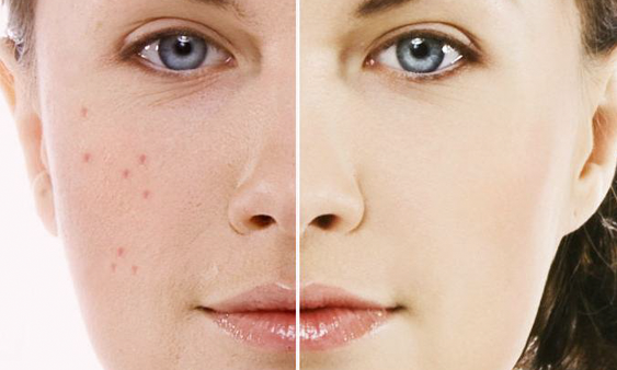 Cách nấu lá đu đủ chữa bệnh tốt nhất