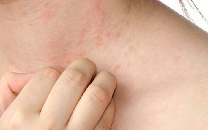 Cách phát hiện ung thư sớm như thế nào và cách phòng bệnh ra sao