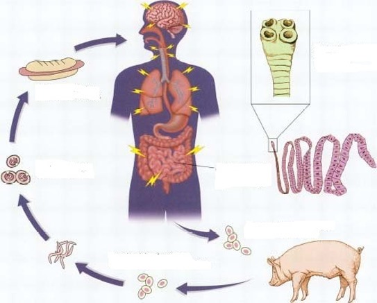 Cách phòng ngừa bệnh sán lợn ở người