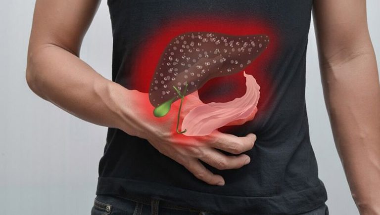 Cách trị gan nhiễm mỡ tại nhà như thế nào