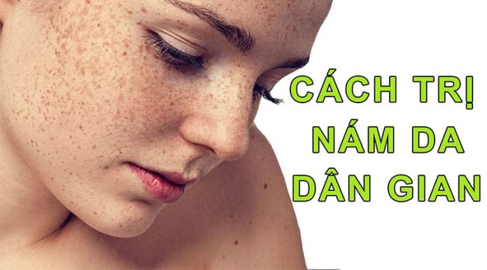 Cách trị nám da bằng mãng cầu xiêm