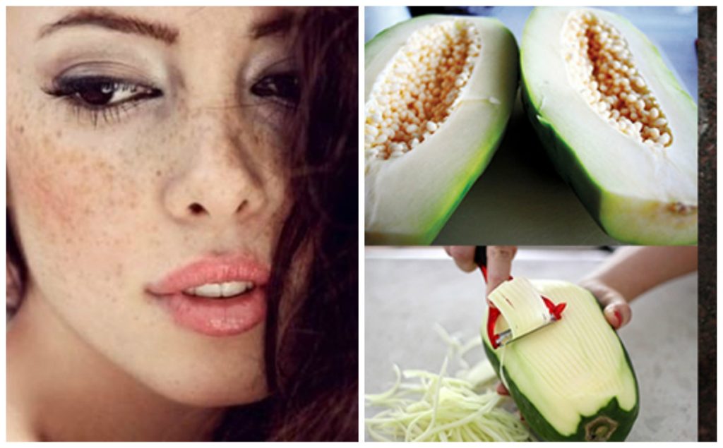 Cách trị tàn nhang hiệu quả