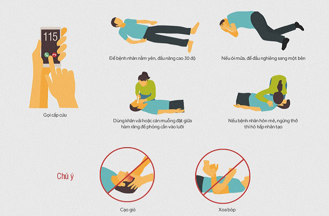 Cách xử trí tai biến mạch máu não như thế nào