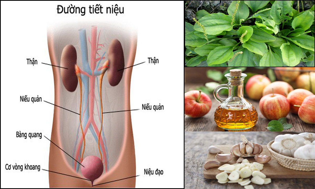 chữa viêm đường tiết niệu đơn giản hiệu quả