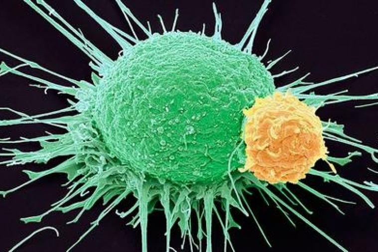 Công dụng của gạo lứt với sức khỏe con người như thế nào