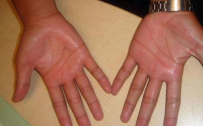 Công dụng của lá lốt với sức khỏe con người như thế nào