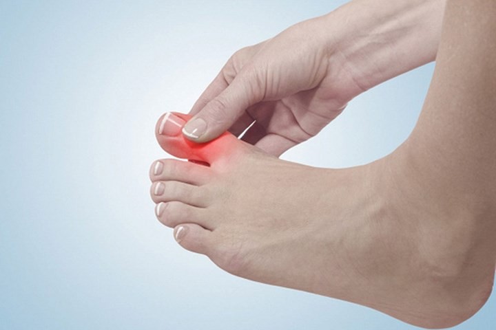 Đau nhức xương khớp chân là gì và cách điều trị ra sao