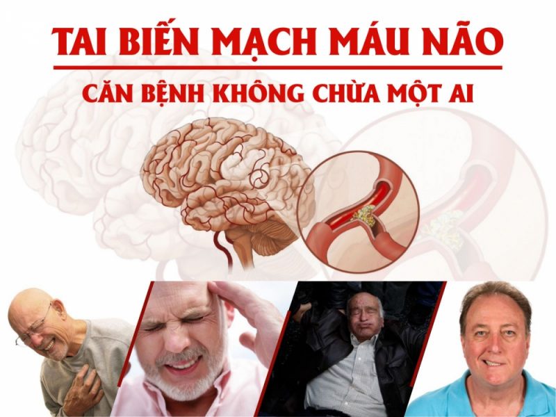 Ngăn chặn nguy cơ nhồi máu cơ tim và tai biến mạch máu não