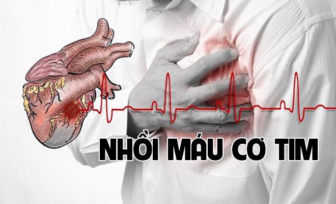 Ngăn chặn nguy cơ nhồi máu cơ tim và tai biến mạch máu não