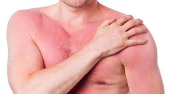 Nóng gan nên uống thuốc gì