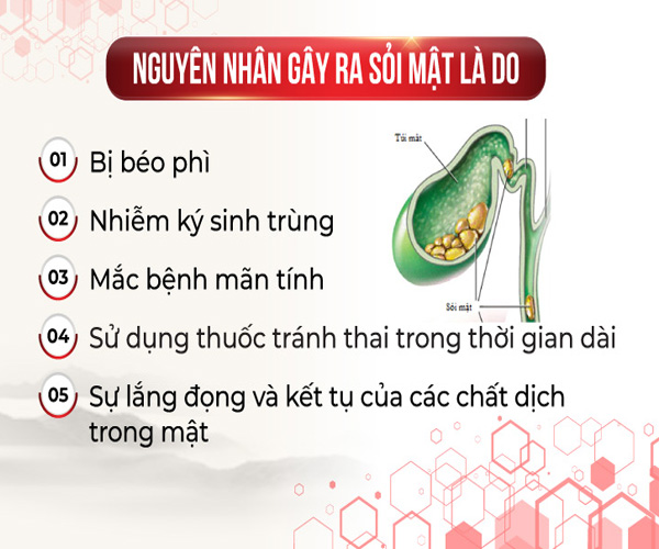 Sỏi túi mật kích thước bao nhiêu thì phải mổ