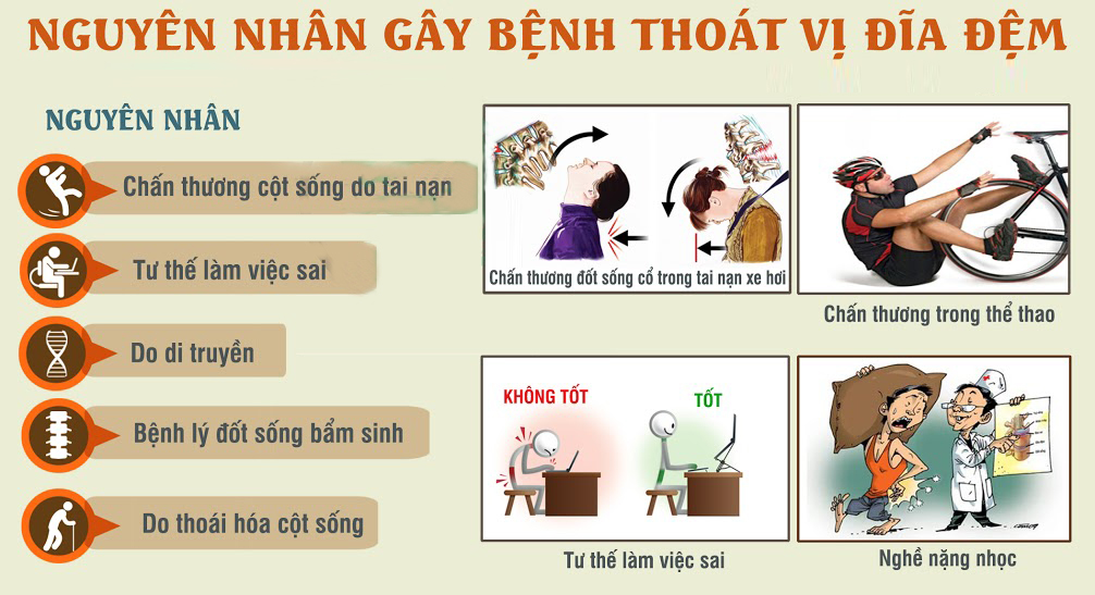 thoát vị đĩa đệm có đi bộ được không và cách điều trị