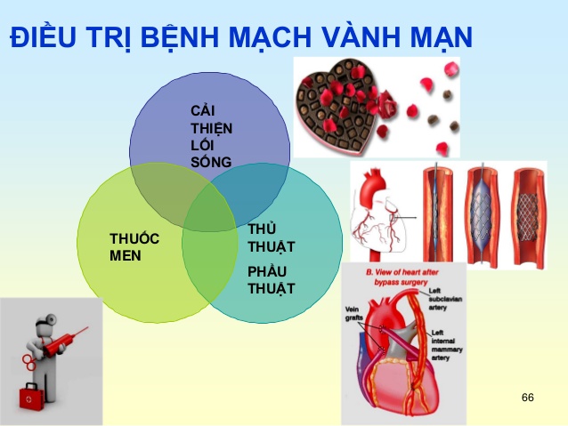 thuốc điều trị bệnh mạch vành