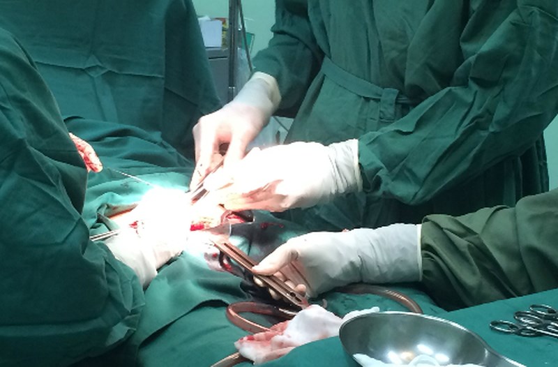 triệu chứng u xơ tuyến tiền liệt