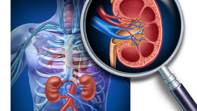 U xơ tiền liệt tuyến có nguy hiểm không và cách phòng bệnh