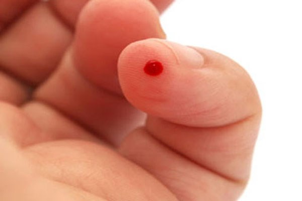 ung thư máu có lây nhiễm không