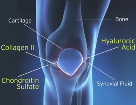 Viêm khớp cổ tay uống thuốc gì tốt nhất hiện nay