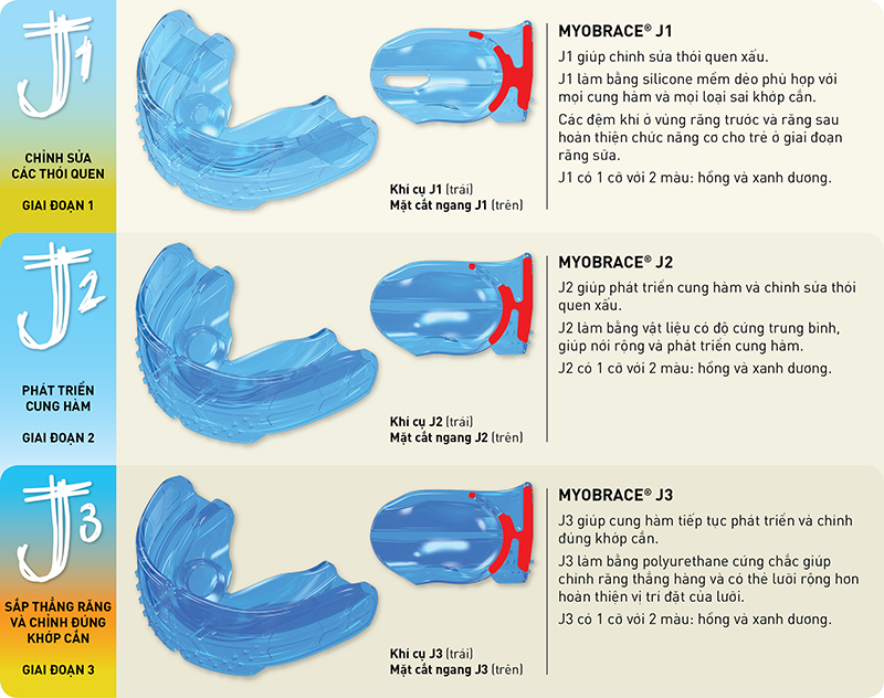 nguyên nhân thật sự đưa đến sai khớp cắn