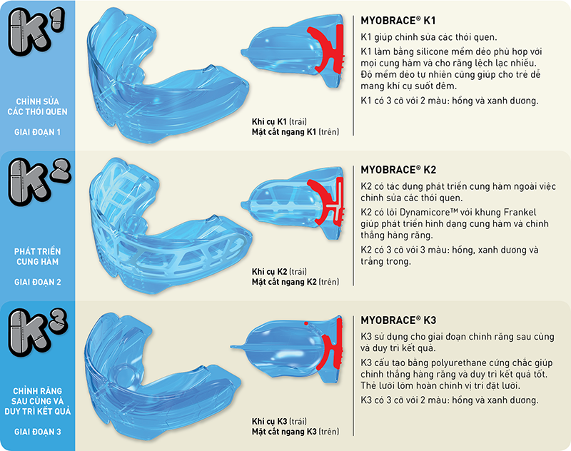 trẻ em có răng mọc chen chúc và hàm bị lệch lạc