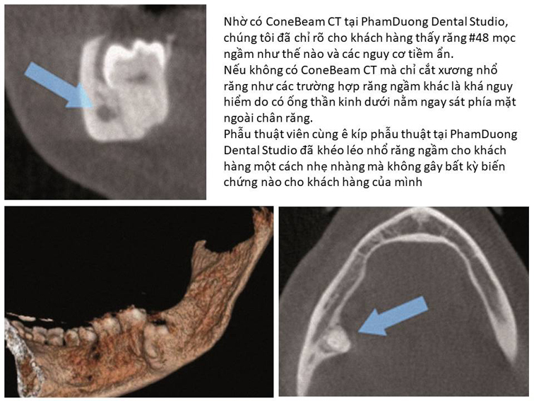 Máy chụp film Cone Beam CT để chẩn đoán