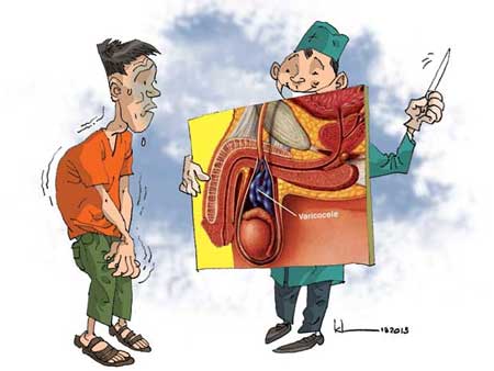 Giãn tĩnh mạch thừng tinh: đừng quá lo!