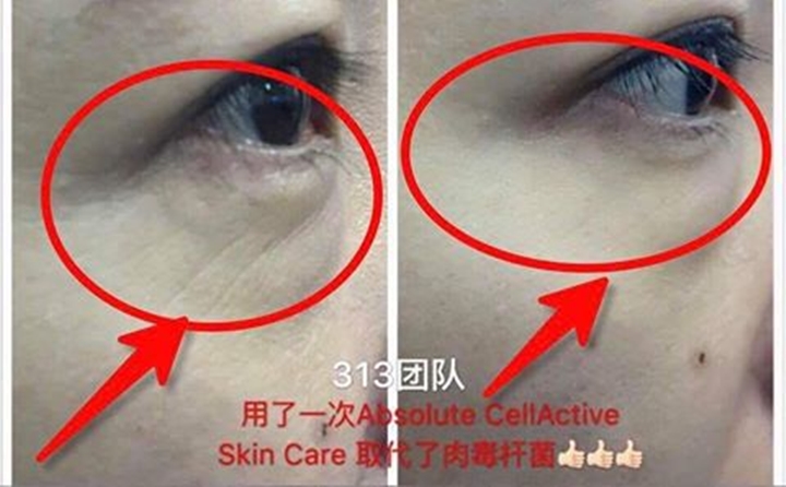 Kem xóa nhăn, bọng và thâm quầng mí mắt - Absolute Cellactive Eye-Complex