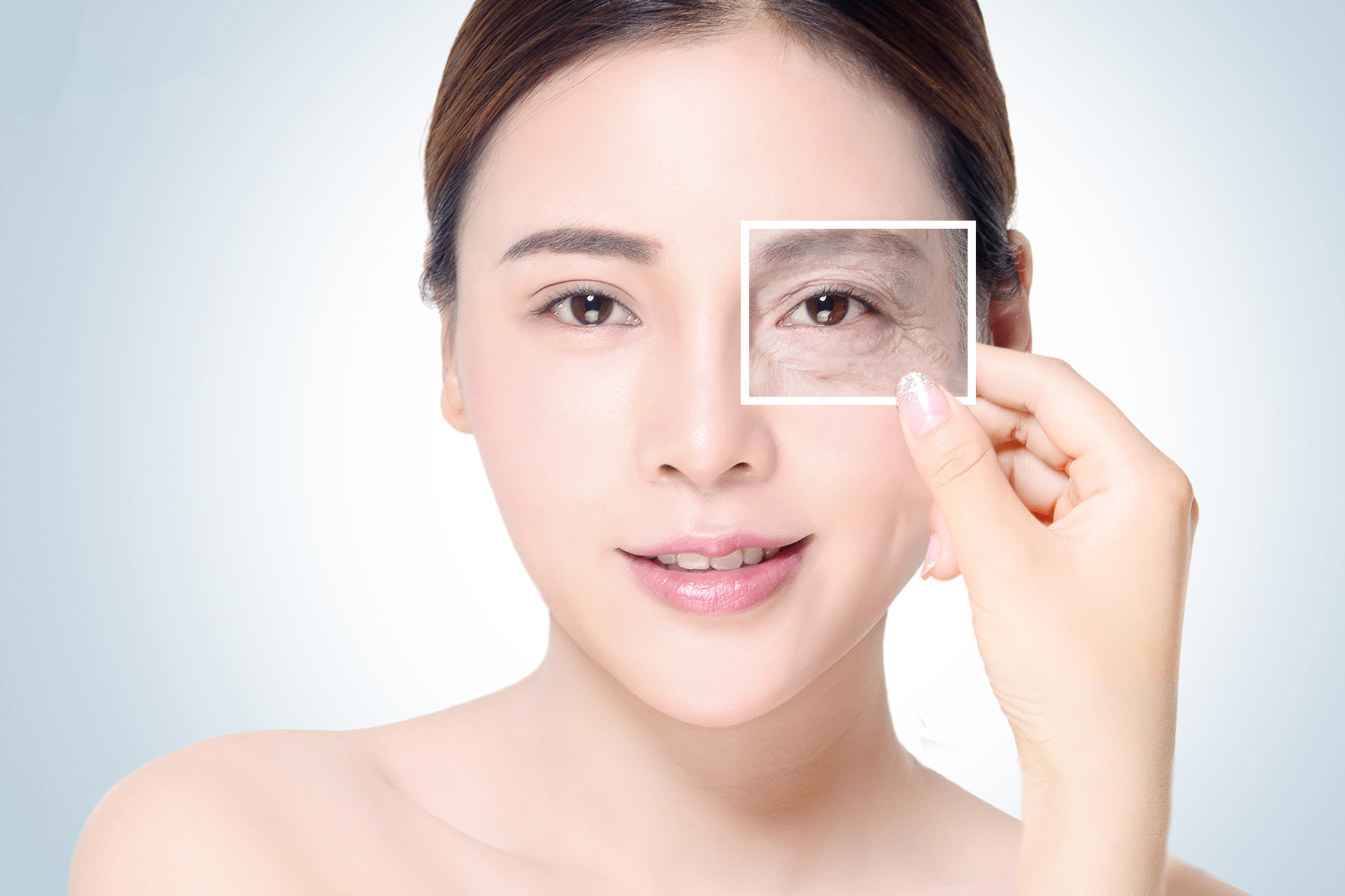 kỹ thuật tiêm botox