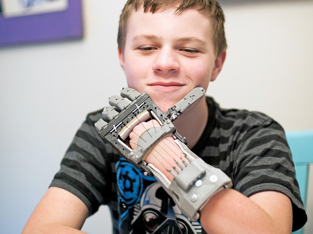 Giám đốc 25 tuổi và dự án tay giả in 3D cứu giúp hàng nghìn trẻ khuyết tật