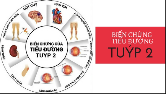 biến chứng của tiểu đường type 2