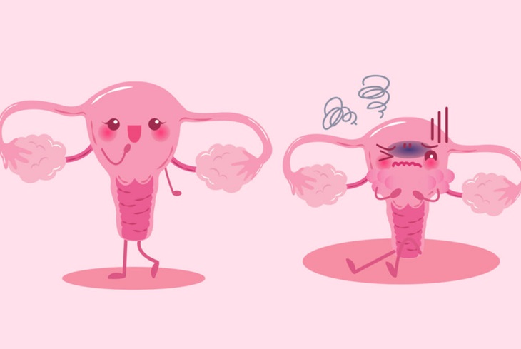 Top 6 dấu hiệu cảnh báo viêm nhiễm âm đạo chị em cần đặc biệt chú ý