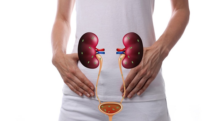 Viêm đường tiết niệu có tự khỏi được không? Làm cách nào để chữa khỏi viêm đường tiết niệu?