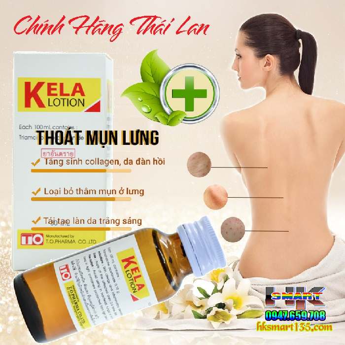 Dưỡng thể đặc trị viêm lỗ chân lông Kela Lotion