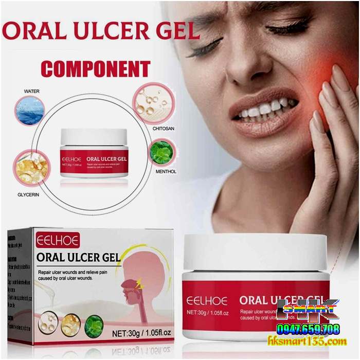 Gel Làm Dịu Giảm Đau Răng Miệng Mouth Oral Ulcer 30gr