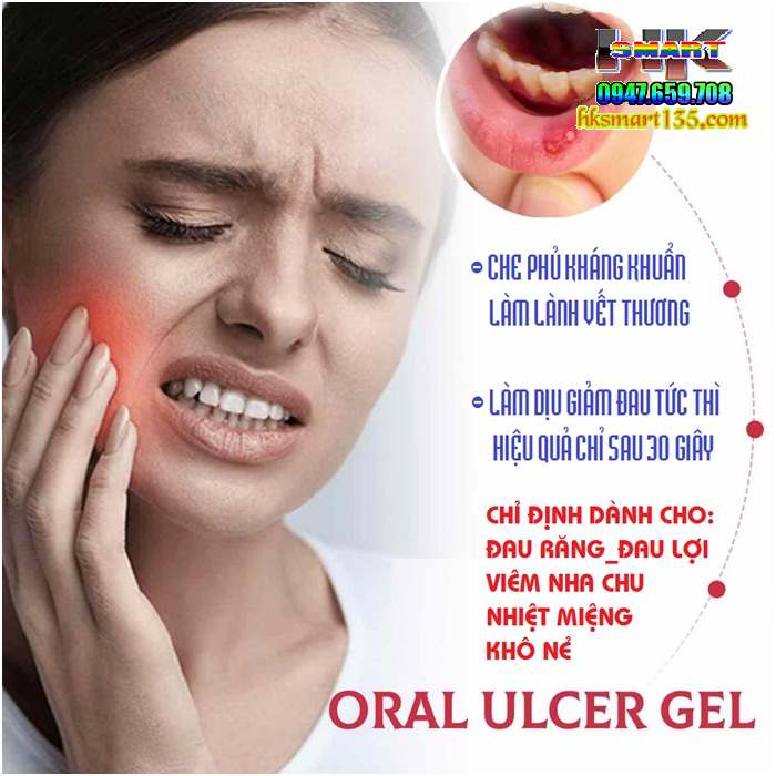 Gel Làm Dịu Giảm Đau Răng Miệng Mouth Oral Ulcer 30gr
