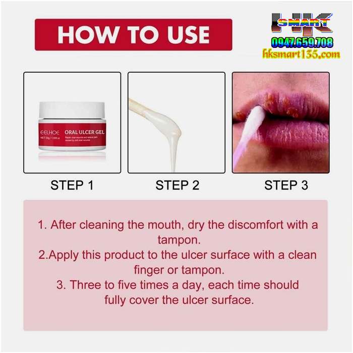 Gel Làm Dịu Giảm Đau Răng Miệng Mouth Oral Ulcer 30gr