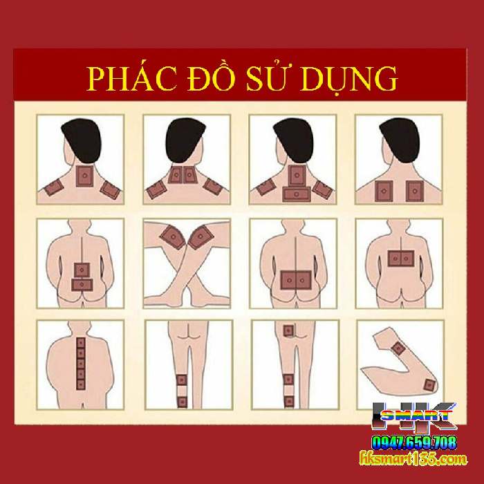 Hộp 12 Miếng dán giảm đau xương khớp, giảm đau bụng kinh